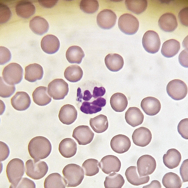 Hematologia