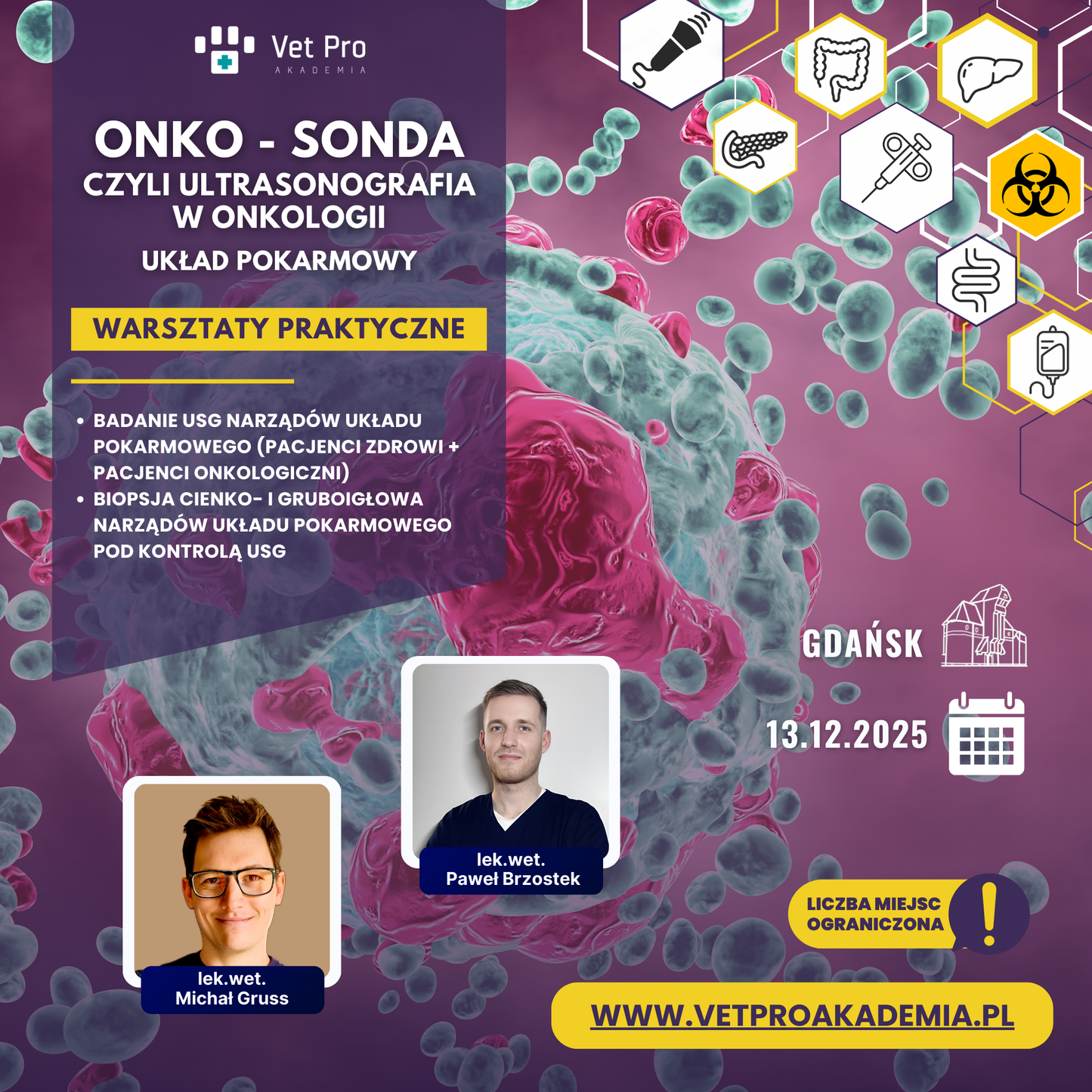 Onko - Sonda czyli ultrasonografia w onkologii - Układ pokarmowy