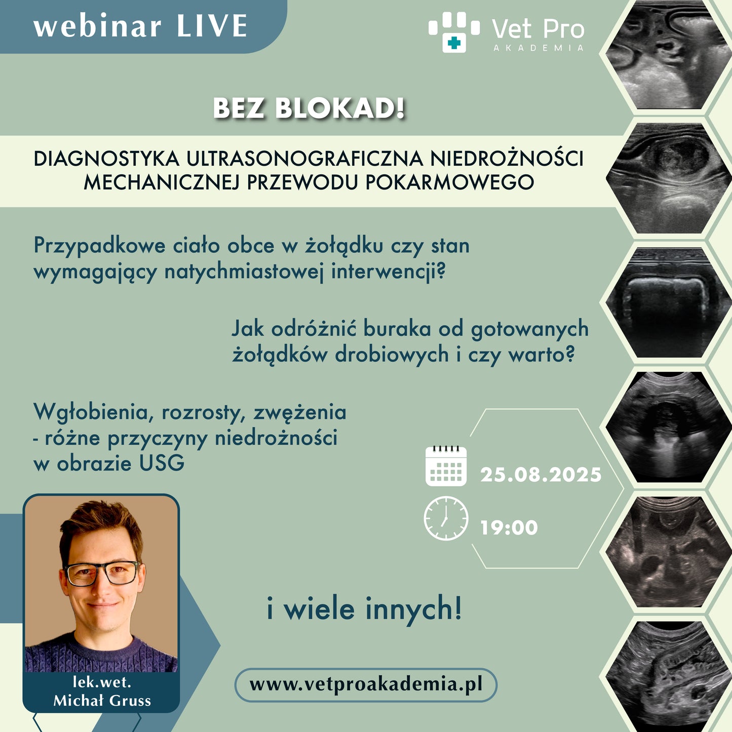 BEZ BLOKAD! Diagnostyka Ultrasonograficzna Niedrożności Mechanicznej Przewodu Pokarmowego